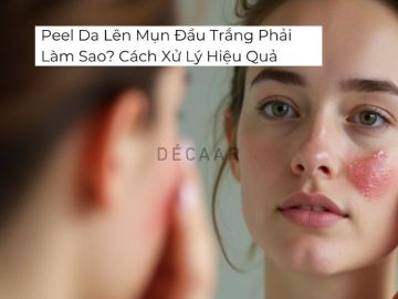 #Peel Da Có Được Uống Cà Phê Không? Các Lưu Ý Quan Trọng