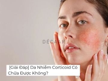 [Giải Đáp] Da Nhiễm Corticoid Có Chữa Được Không?
