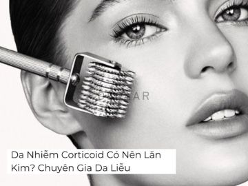 Da Nhiễm Corticoid Có Nên Lăn Kim? Chuyên Gia Da Liễu