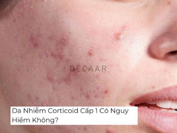 Da Nhiễm Corticoid Cấp 1 Có Nguy Hiểm Không?