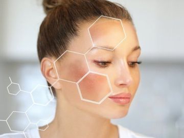 Peel da trị nám: Nồng độ peel hóa học phù hợp từng cấp độ nám