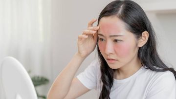 Microbiome giao mùa: Khi hệ vi sinh da mất cân bằng âm thầm