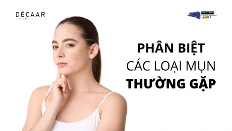 PHÂN BIỆT CÁC LOẠI MỤN THƯỜNG GẶP