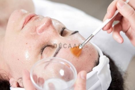 Acid Peel Là Gì? Acid Peel Có Trị Mụn, Thâm Mụn Được Không?