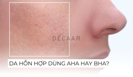 #Da Hỗn Hợp Nên Dùng AHA Hay BHA Sẽ Hiệu Quả Hơn