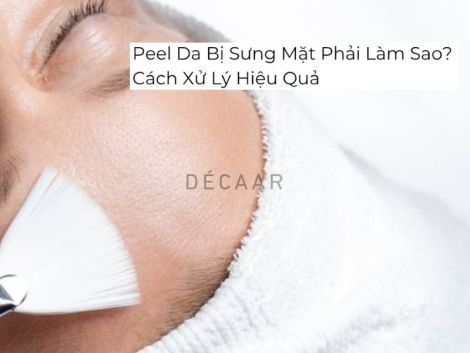 #Peel Da Bị Sưng Mặt Phải Làm Sao? Cách Xử Lý Hiệu Quả