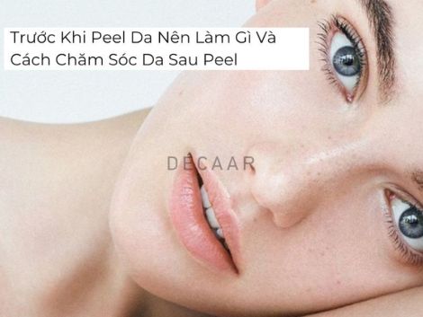 #Trước Khi Peel Da Nên Làm Gì Và Cách Chăm Sóc Da Sau Peel