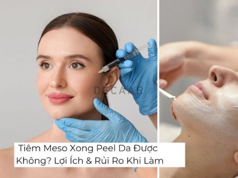 Tiêm Meso Xong Peel Da Được Không? Lợi Ích & Rủi Ro Khi Làm