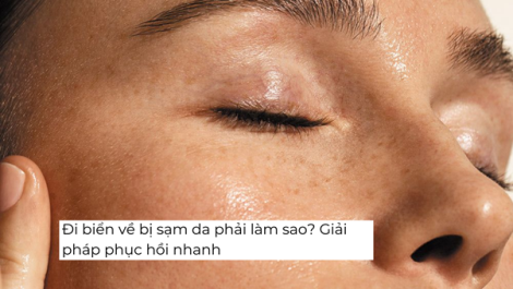 Đi biển về bị sạm da phải làm sao? Giải pháp phục hồi nhanh chóng hữu hiệu