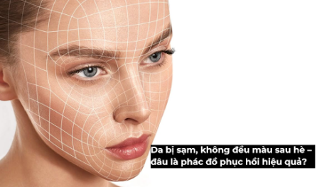 Da bị sạm, không đều màu sau hè – đâu là phác đồ phục hồi hiệu quả?