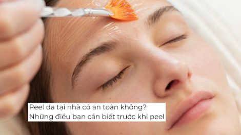 Peel da tại nhà có an toàn không? Những điều bạn cần biết trước khi peel