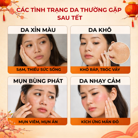 Phục hồi da sau Tết: Chiến lược tái cân bằng, căng bóng, sáng khỏe