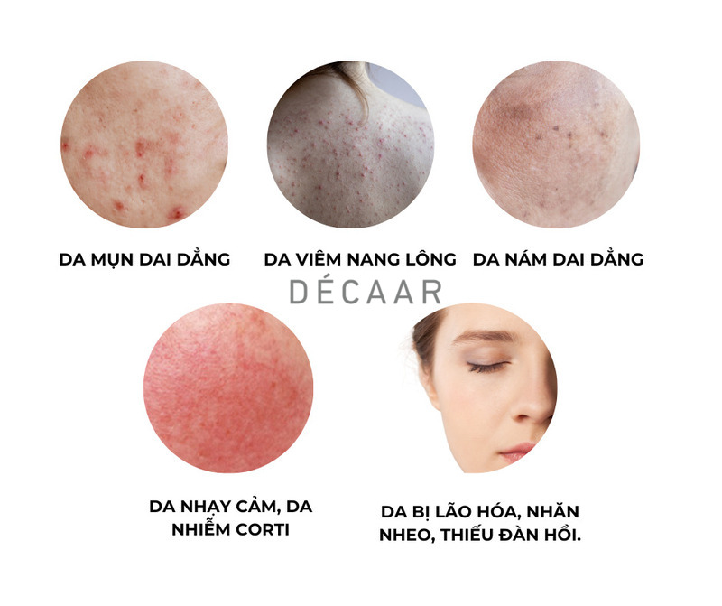 #Peel Da Là Gì? Có Tốt Không? Tác Dụng Của Peel Da