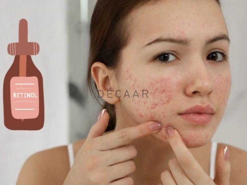 retinol