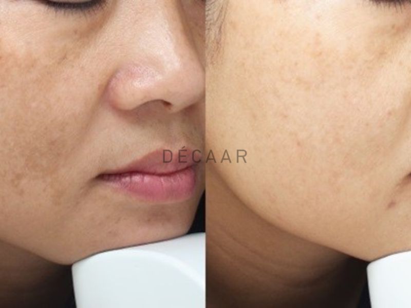 retinol