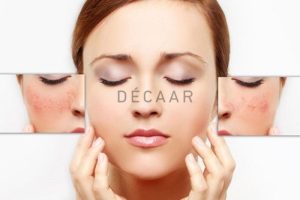 Các Cách Trị Nám Da Mặt Hiệu Quả Và Tốt Nhất Hiện Nay