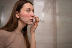 #Peel Da Bị Bỏng Phải Làm Sao? Cách Xử Lý Nhanh Nhất