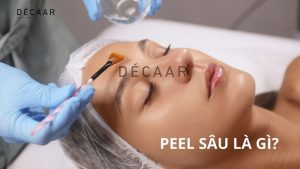 #Peel Da Sâu Là Gì? Hiệu Quả Của Liệu Trình Peel Da Chuyên Sâu