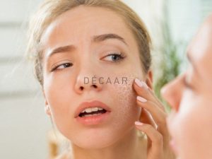 #Cách Phục Hồi Da Bị Cháy Nắng Nhanh Nhất, An Toàn Hiệu Quả