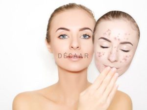 #Bí Quyết Phục Hồi Da Hư Tổn An Toàn Hiệu Quả