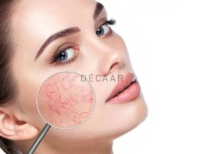 #Da Mỏng Có Nên Peel Da Không? Cần Lưu Ý Gì?