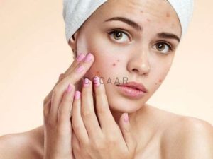 #Mục Bọc Không Đầu Là Gì? Cách Trị Mụn Bọc Không Đầu