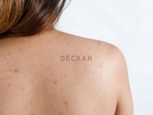 #Viêm Nang Lông Ở Lưng Và Cách Điều Trị Triệt Để