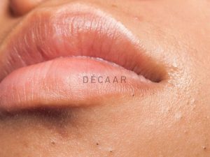 #Các Cách Trị Mụn Đầu Đen Quanh Miệng Nhanh Và Hiệu Quả