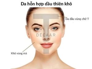 #Da Hỗn Hợp Thiên Khô Nên Dùng AHA Hay BHA?