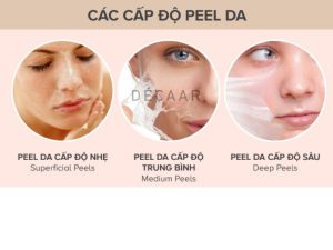 #Mặt Nạ Peel Da Và Những Điều Bạn Cần Biết Để Tránh Rủi Ro