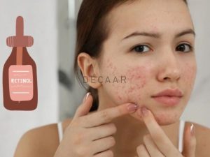 #Retinol Là Gì? Phân Loại, Tác dụng Và Hướng Dẫn Sử Dụng