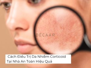 Cách Điều Trị Da Nhiễm Corticoid Tại Nhà An Toàn Hiệu Quả