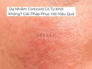 Da Nhiễm Corticoid Có Tự Khỏi Không? Giải Pháp Phục Hồi Hiệu Quả