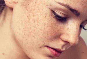 Chống oxy hóa: Bí quyết da sáng bền vững