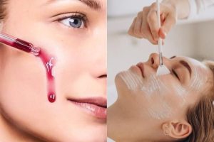 5 Công Nghệ Peel Da Mới Nhất Dành Cho Trị Nám Năm 2026