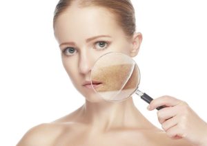 Sai Lầm Phổ Biến Khi Peel Da Trị Nám Khiến Tình Trạng Đậm Hơn