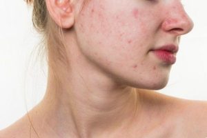 Khi Nào Da Cần “Phục Hồi Sinh Học” Thay Vì Treatment Mạnh?